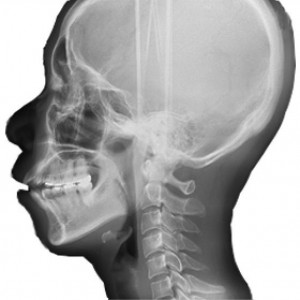 radiologia